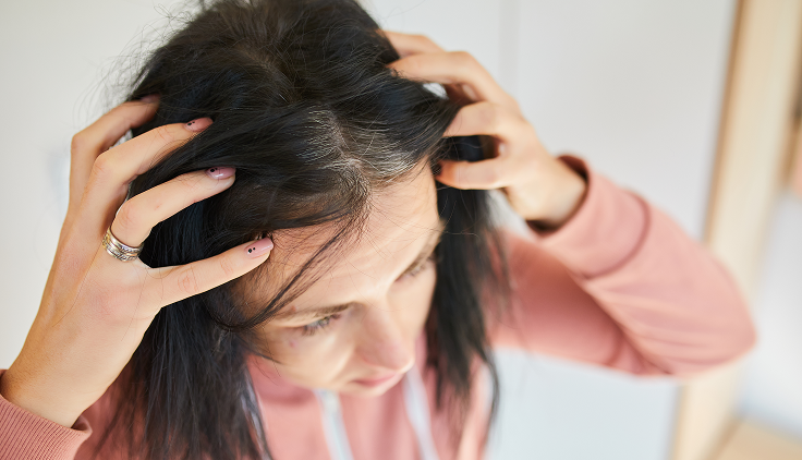 mujer examinando su cabeza por dolor en el cuero cabelludo